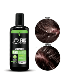 Shampoo Anti-Caspa 240ml – Fox For Men