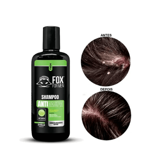 Shampoo Anti-Caspa 240ml – Fox For Men
